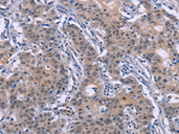 Rabbit Polyclonal Antibody to DVL2