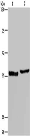 SLC1A6