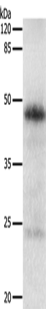 EDA