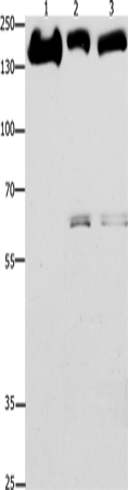 EGFR