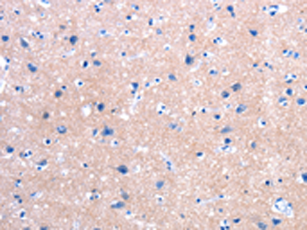 FPR2