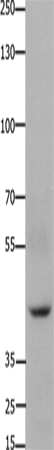 FOXD3
