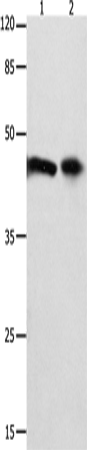 FOXL1 