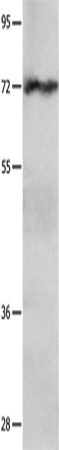 IGF2BP1