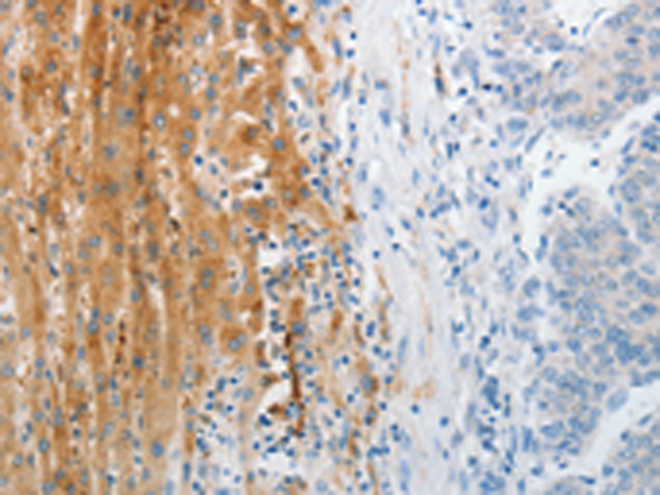 TRPM1