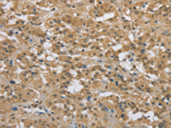 PKD1