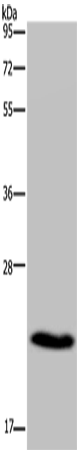CMTM5