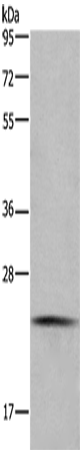 CMTM6