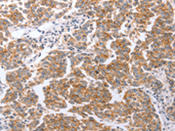 CLDN3