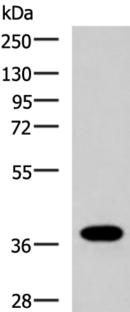 GPR6 