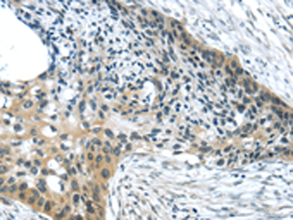 HCN4