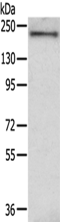 IQGAP2