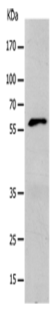 KCNC1