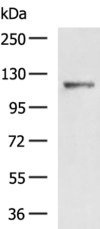 LRIG1