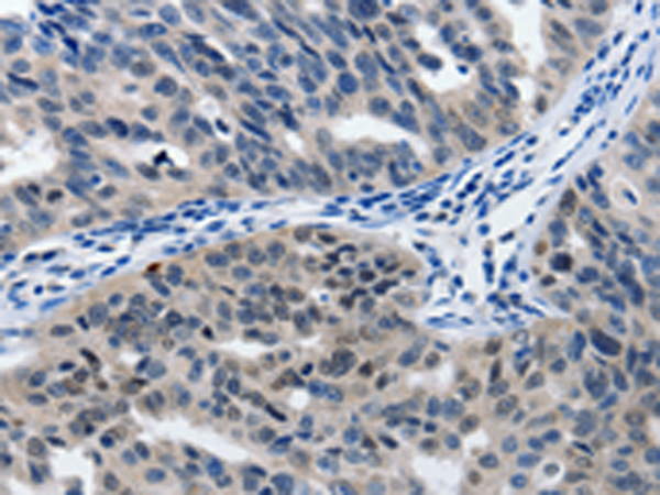 Rabbit Polyclonal Antibody to MATN1