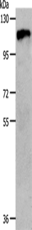 CSF1R