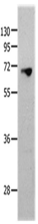 MMP25