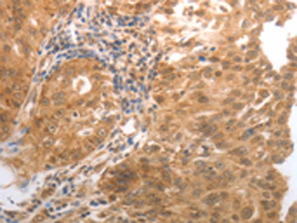 Rabbit Polyclonal Antibody to MMP27