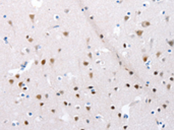 Rabbit Polyclonal Antibody to POMC