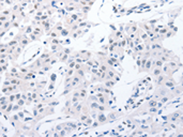 Rabbit Polyclonal Antibody to POMC