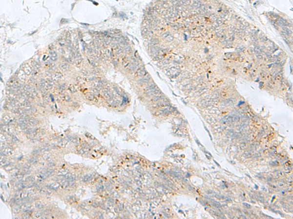 Rabbit Polyclonal Antibody to MLNR