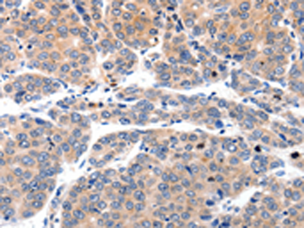 Rabbit Polyclonal Antibody to MYL9