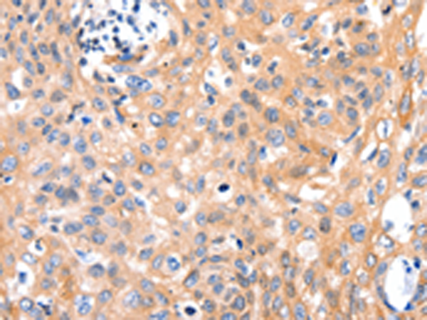 Rabbit Polyclonal Antibody to MYL9