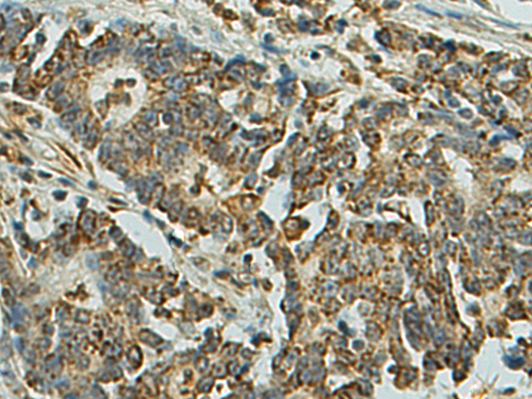 Rabbit Polyclonal Antibody to CHRNA1