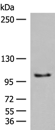 CDH1