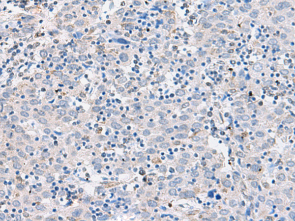 CDH2