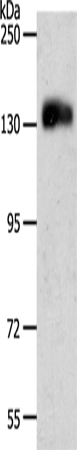 PECAM1