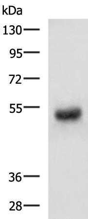 PDK4