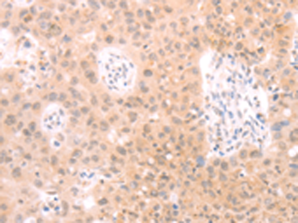 PKD2L1