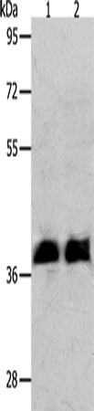 RNF126