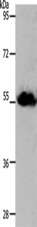 SLC1A4