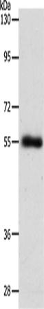 SLC1A5