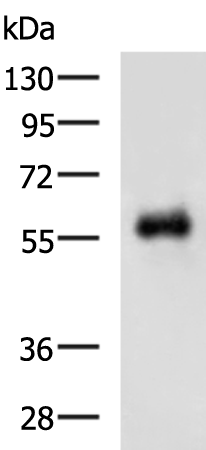 HNF1B