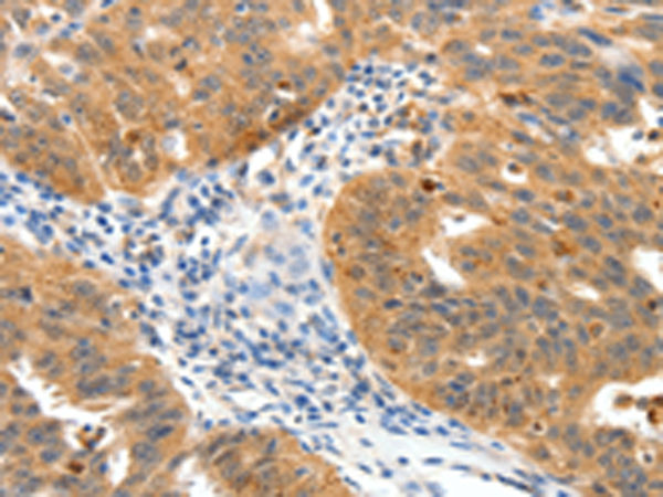Rabbit Polyclonal Antibody to TPM2