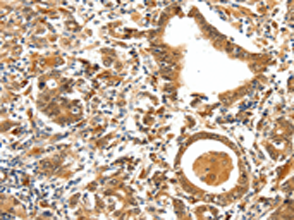 Rabbit Polyclonal Antibody to TPM2