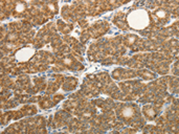 Rabbit Polyclonal Antibody to COL4A3