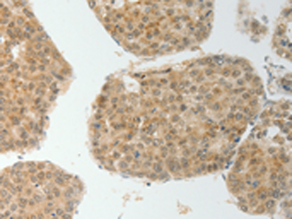 Rabbit Polyclonal Antibody to TWIST1