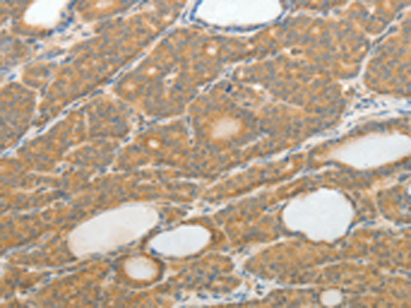 Rabbit Polyclonal Antibody to TH