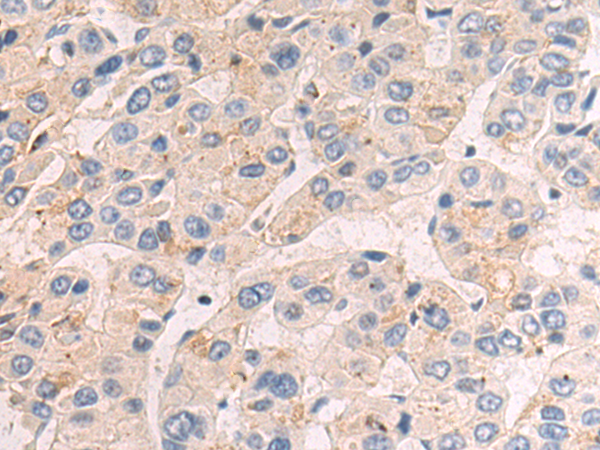 Rabbit Polyclonal Antibody to VEGFA
