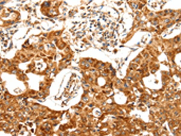 Rabbit Polyclonal Antibody to DOP1A