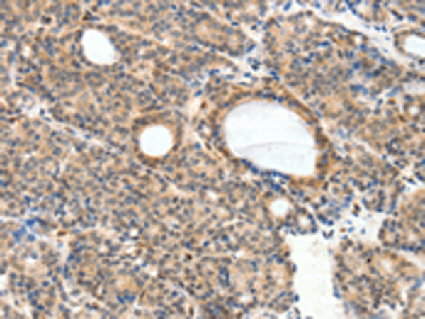Rabbit Polyclonal Antibody to NFATC2