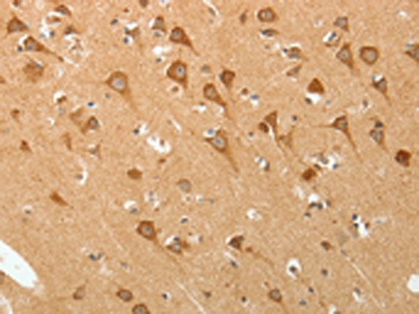 PGBD5 