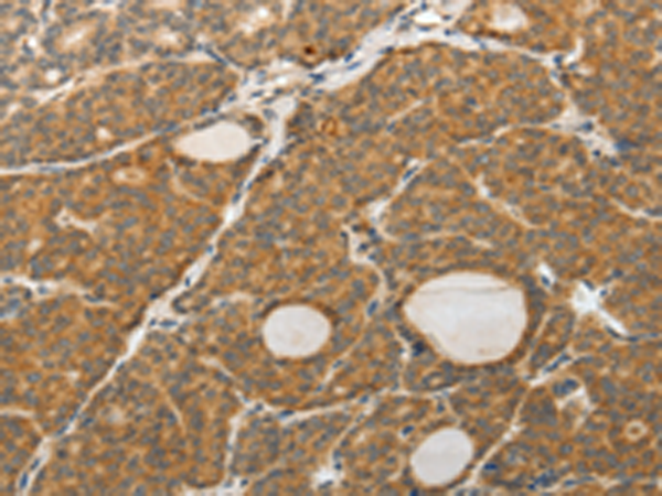 Rabbit Polyclonal Antibody to PGBD5 