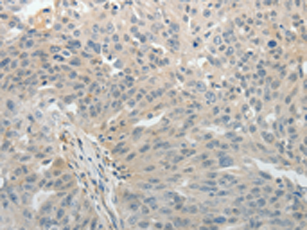 Rabbit Polyclonal Antibody to ABCB11