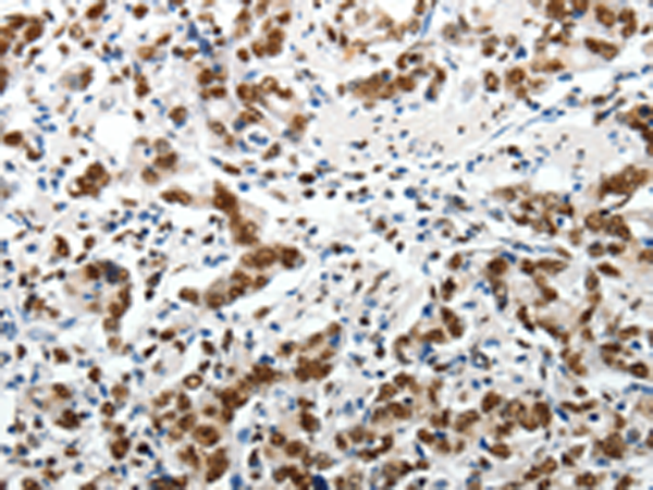 Rabbit Polyclonal Antibody to ABI3BP