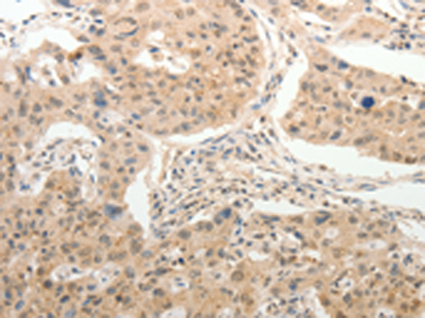 Rabbit Polyclonal Antibody to ADAR